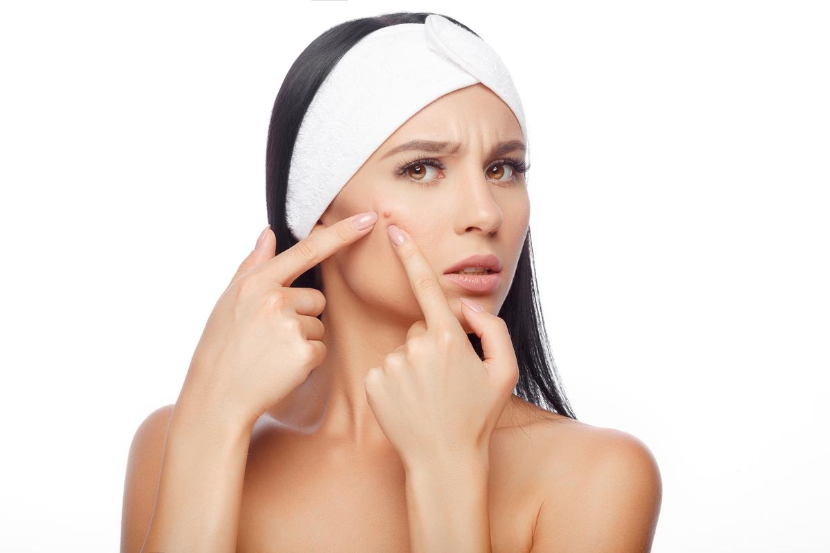 The science behind your acne breakouts