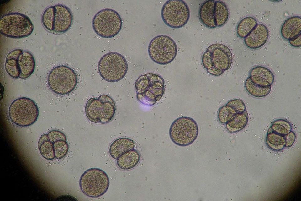How Are Plant Cells Different Than Fungi Cells?